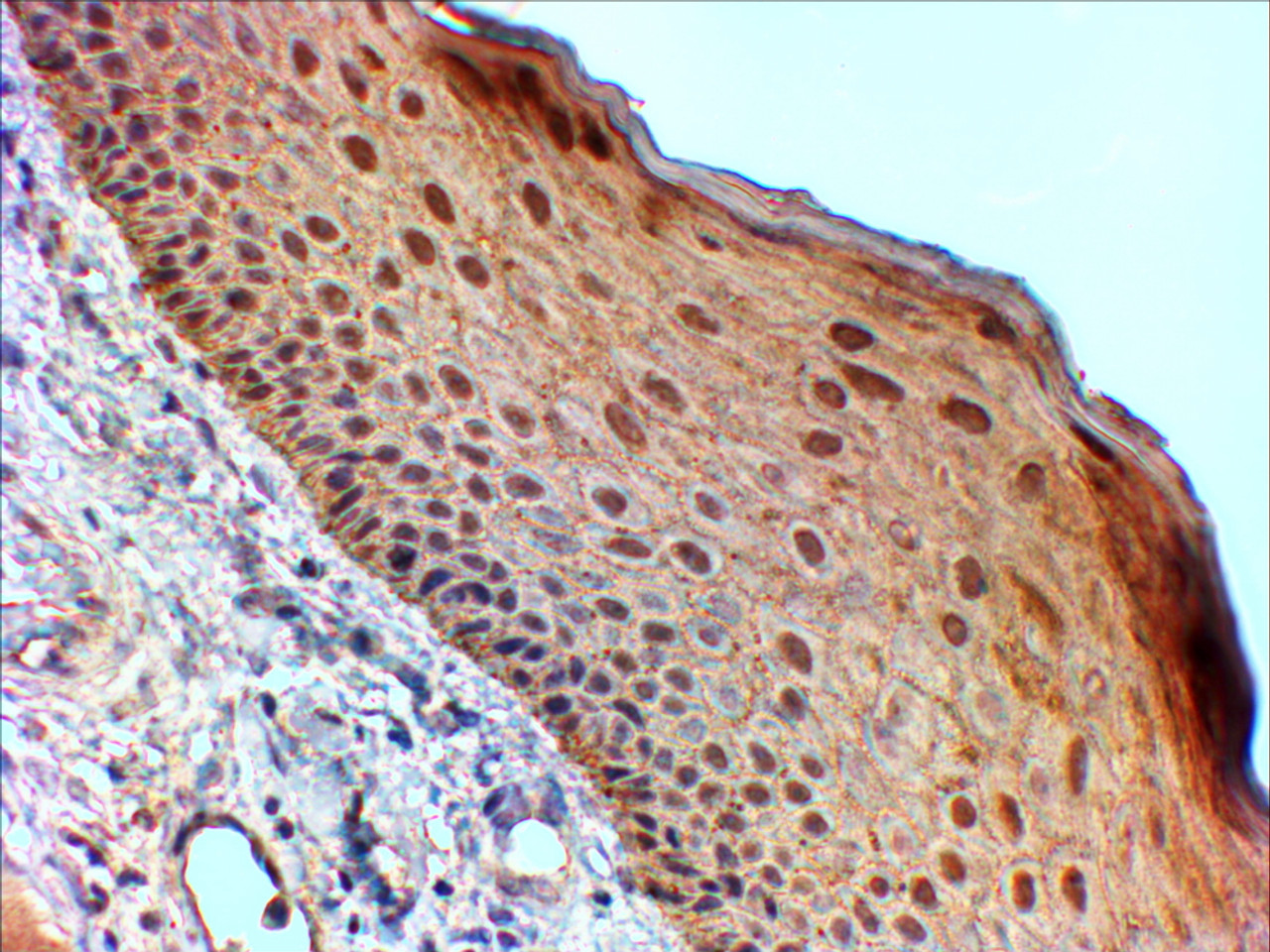 45-174 (0.03ug/ml) staining of Human Skin lysate (35ug protein in RIPA buffer) . Primary incubation was 1 hour. Detected by chemiluminescence.