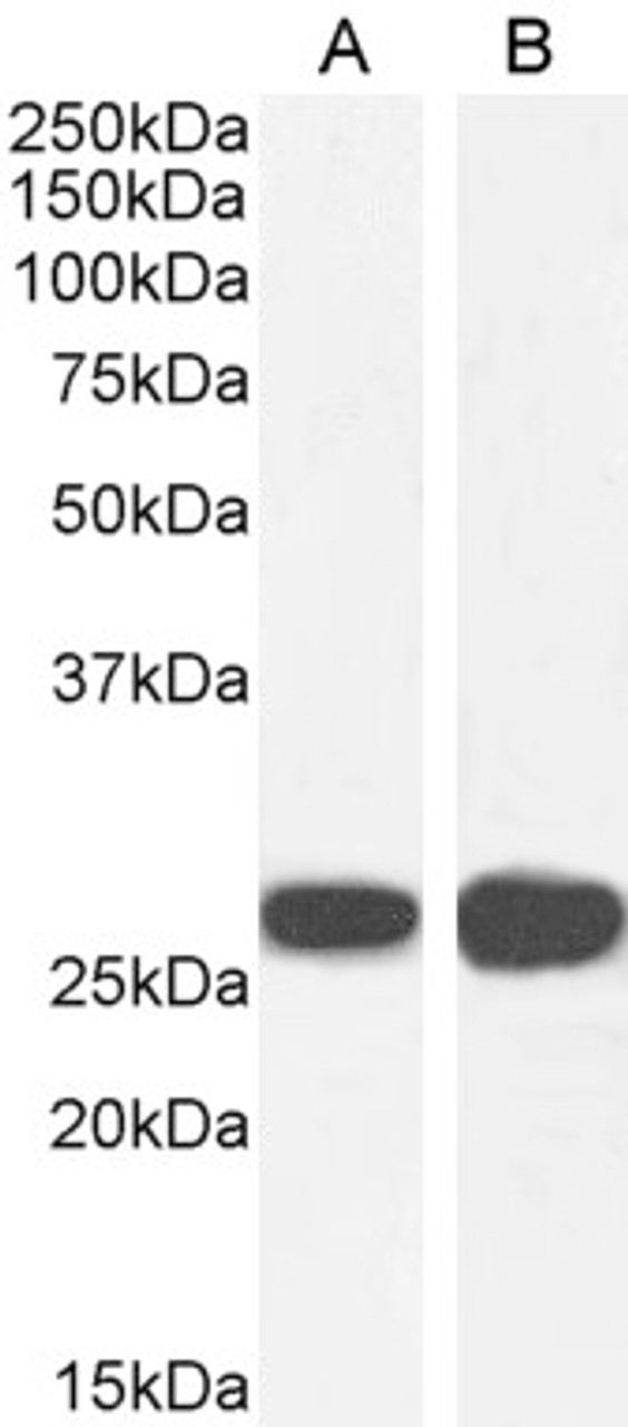 45-174 (2ug/ml) staining of paraffin embedded Human Skin. Steamed antigen retrieval with Tris/EDTA buffer pH 9, HRP-staining.