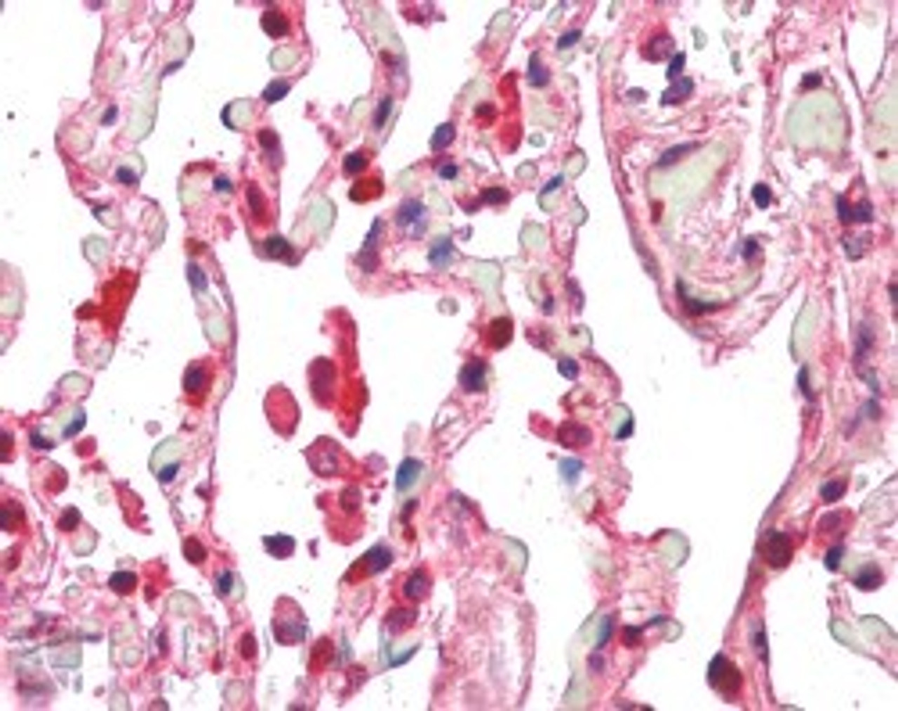 45-192 (5ug/ml) staining of paraffin embedded Human Lung. Steamed antigen retrieval with citrate buffer pH 6, AP-staining.