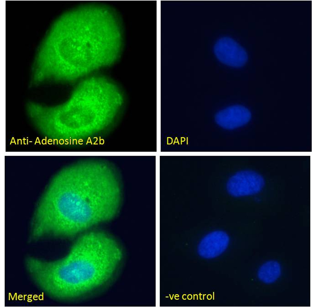 45-206 Immunofluorescence analysis of paraformaldehyde fixed A431 cells, permeabilized with 0.15% Triton. Primary incubation 1hr (10ug/ml) followed by Alexa Fluor 488 secondary antibody (2ug/ml) , showing cytoplasmic staining. The nuclear stain is DAPI (b