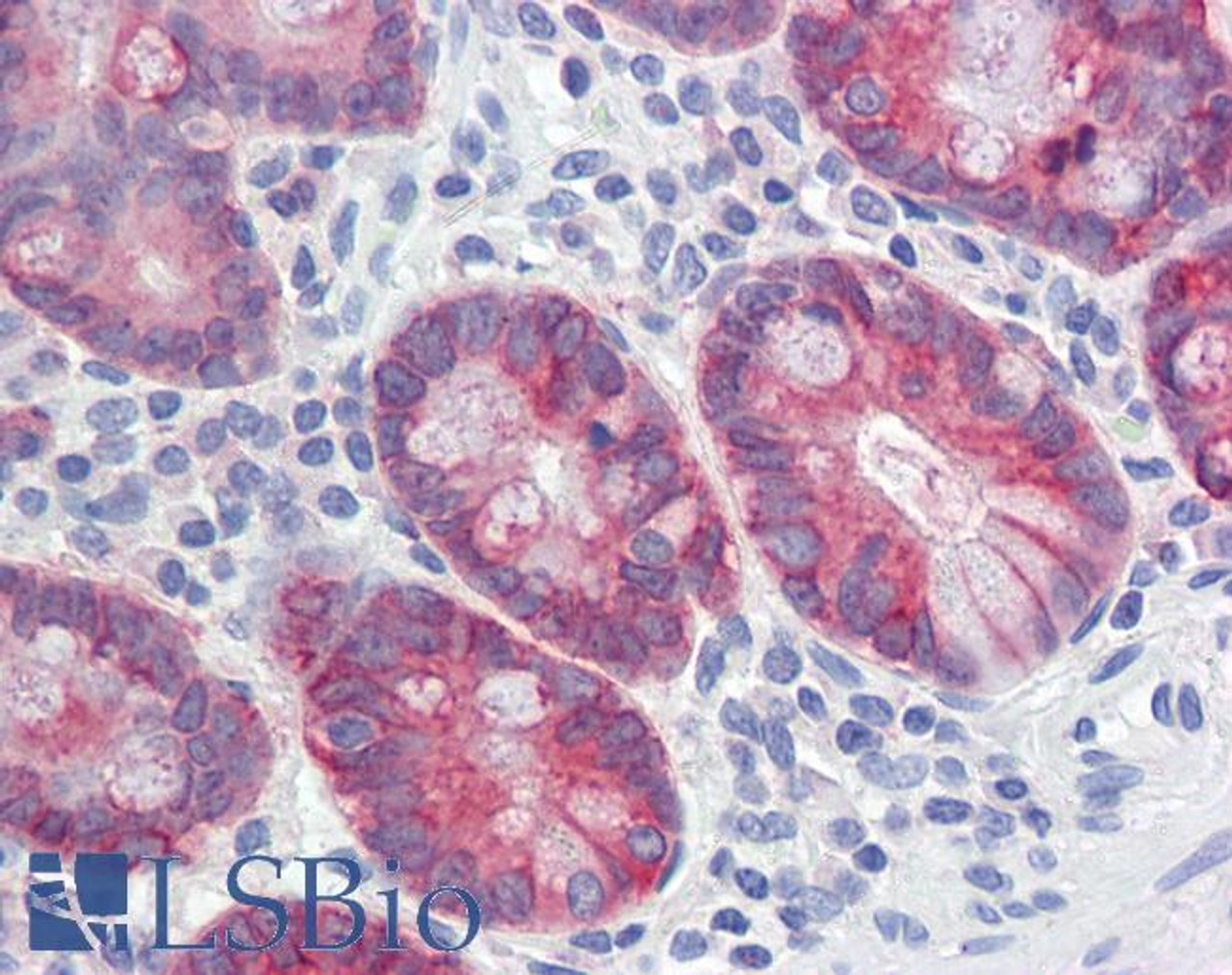 45-214 (0.01ug/ml) staining of Human Colon lysate (35ug protein in RIPA buffer) . Primary incubation was 1 hour. Detected by chemiluminescence.