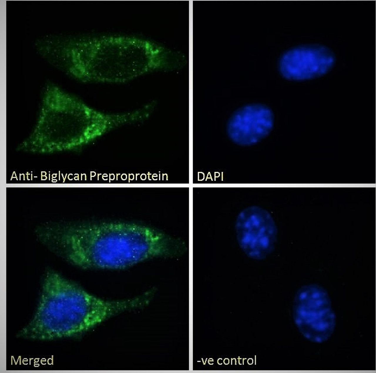 45-214 (5ug/ml) staining of paraffin embedded Human Colon. Steamed antigen retrieval with citrate buffer pH 6, AP-staining. <strong>This data is from a previous batch, not on sale.</strong>