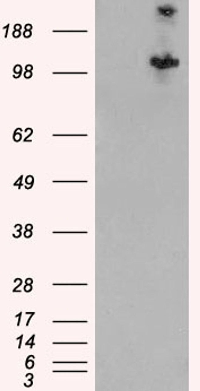 46-535 (0.1µg/ml) staining of Human Brain lysate (35µg protein in RIPA buffer) . Detected by chemiluminescence.