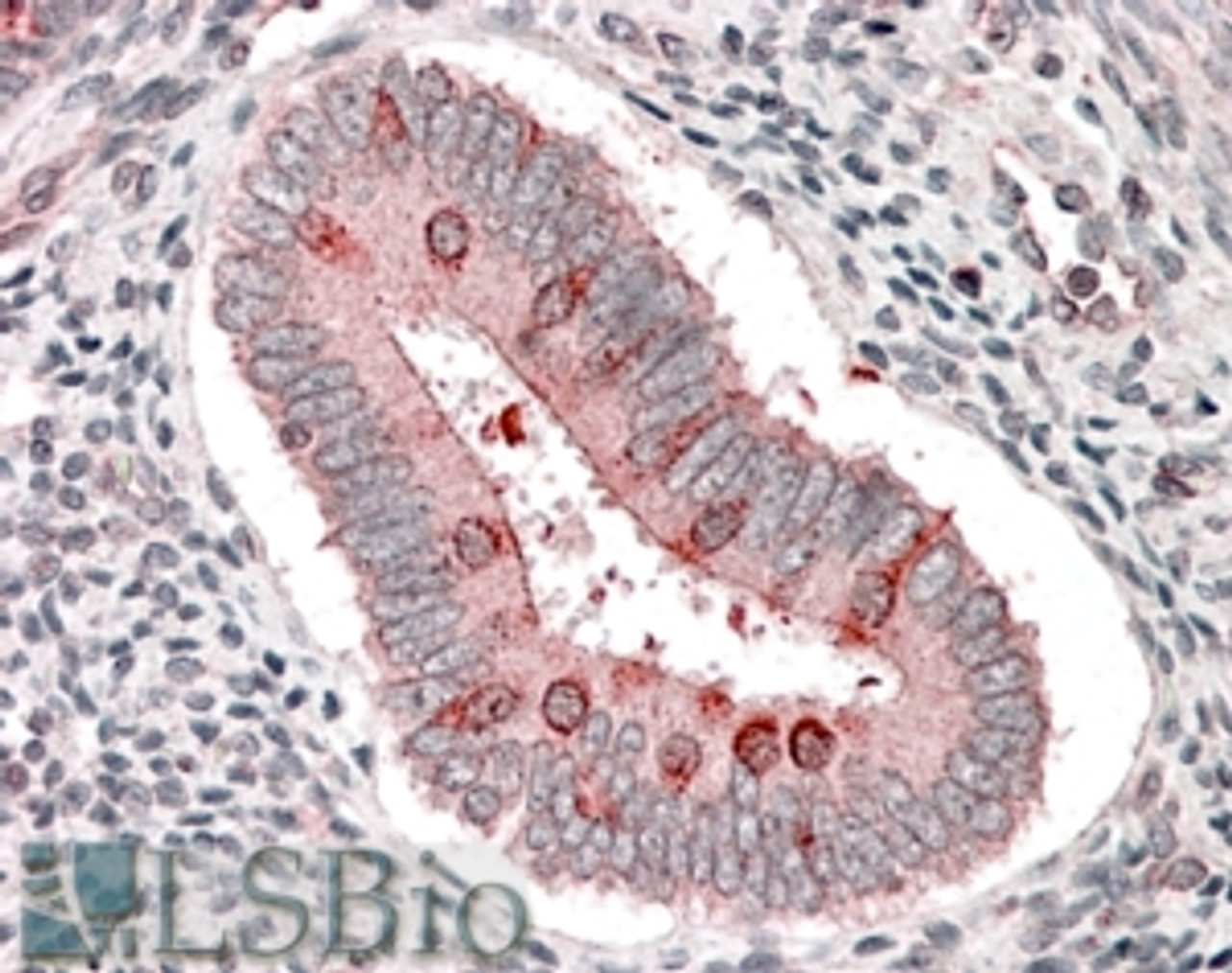 46-535 (3.75µg/ml) staining of paraffin embedded Human Uterus. Steamed antigen retrieval with citrate buffer pH 6, AP-staining.