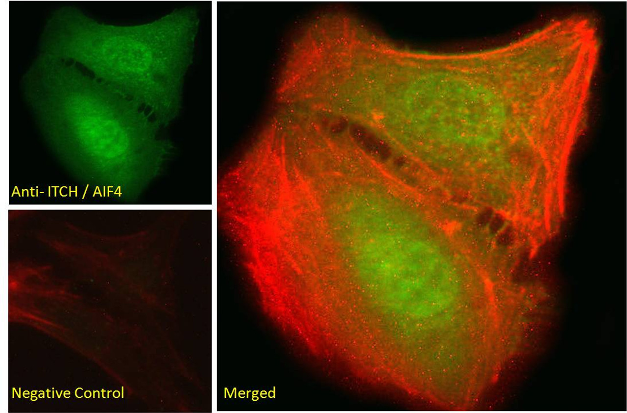 45-222 (0.1ug/ml) staining of Human Brain (Frontal Cortex) lysate (35ug protein in RIPA buffer) . Detected by chemiluminescence.