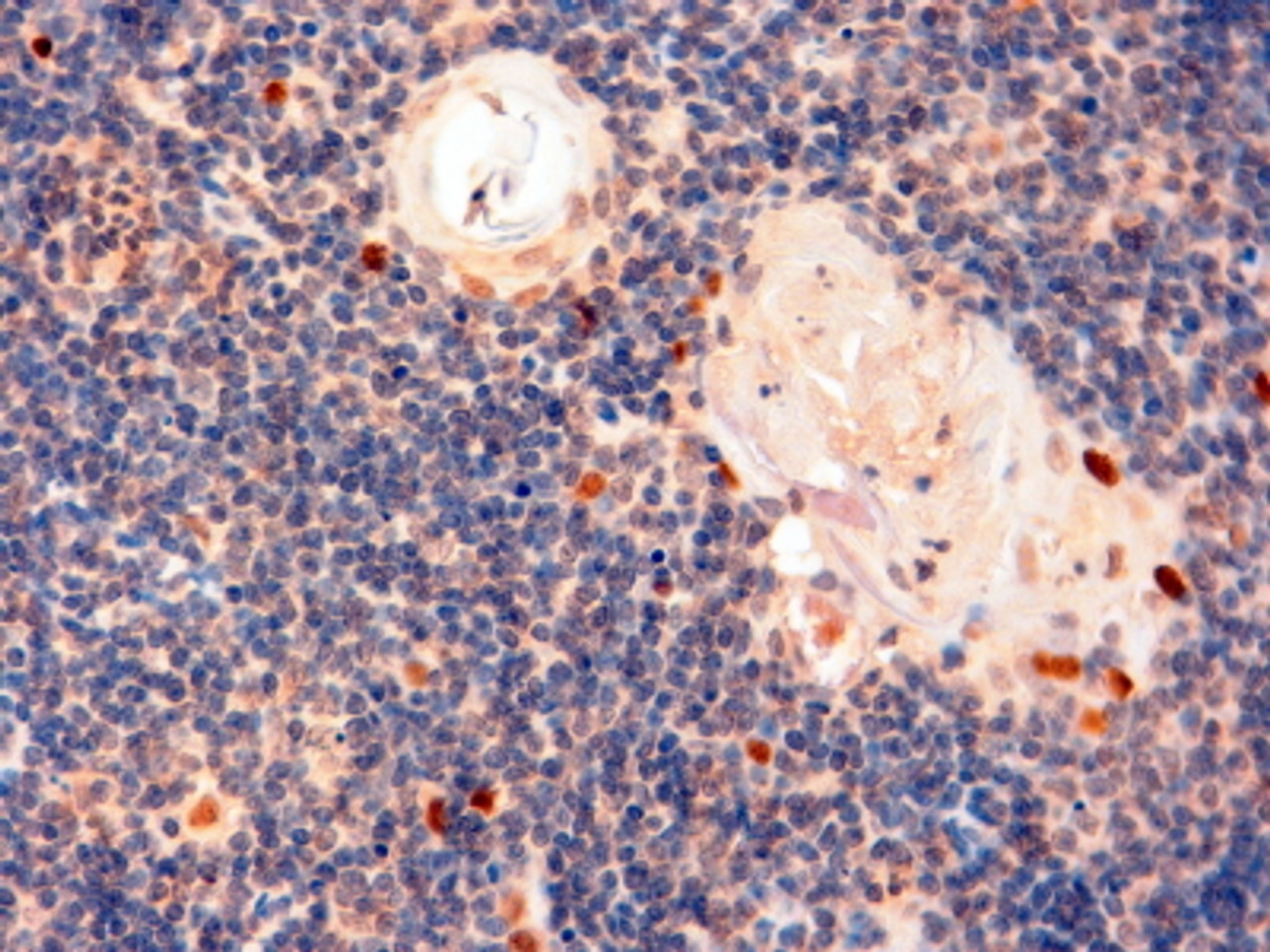 45-225 (2ug/ml) staining of paraffin embedded Human Thymus. Steamed antigen retrieval with Tris/EDTA buffer pH 9, HRP-staining.