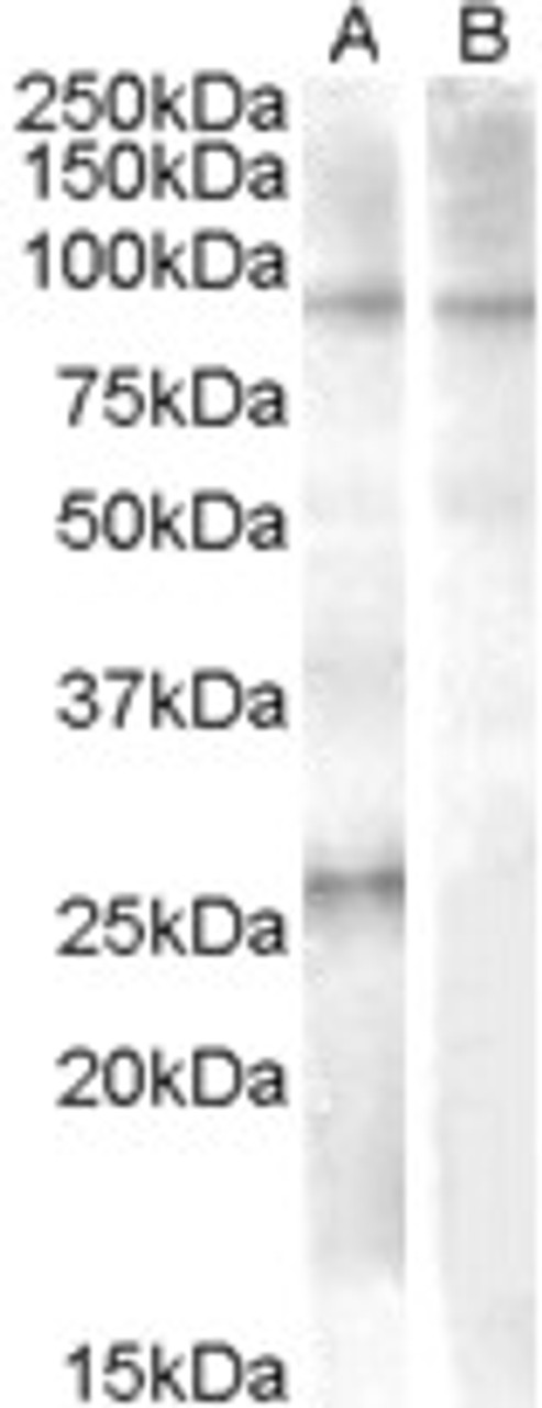 45-234 (0.03ug/ml) staining of A549 cell lysate (35ug protein in RIPA buffer) . Primary incubation was 1 hour. Detected by chemiluminescence.