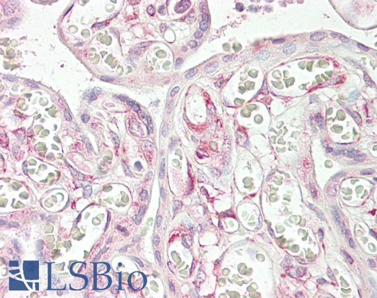 HEK293 overexpressing AKR1B10 with C-terminal tag (DYKDDDDK) and probed with anti-DYKDDDDK in the left panel and with 45-234 in the right panel (mock transfection in first and last lanes) .