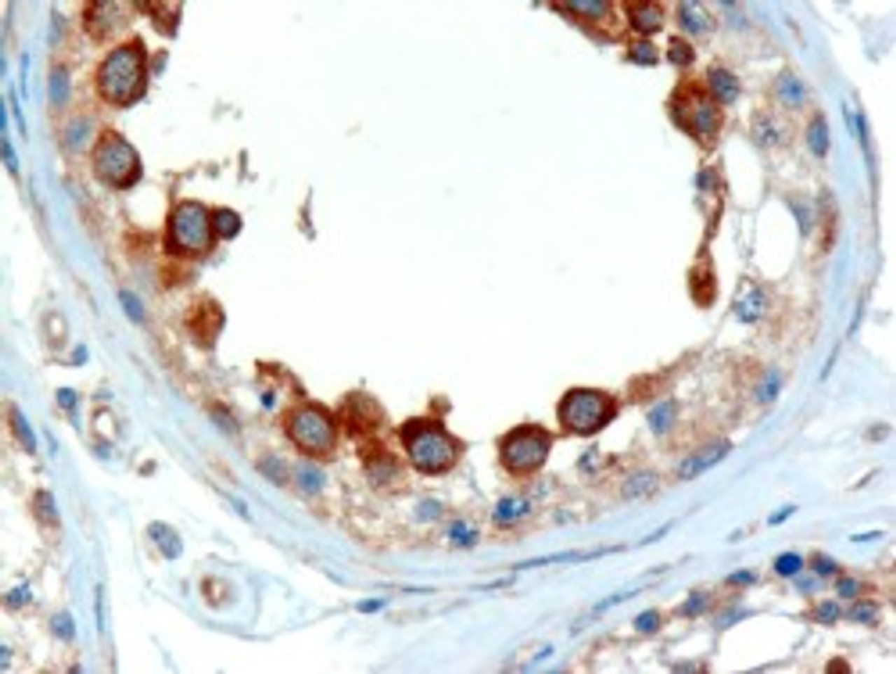 45-240 (2ug/ml) staining of paraffin embedded Human Testis. Microwaved antigen retrieval with Tris/EDTA buffer pH9, HRP-staining.