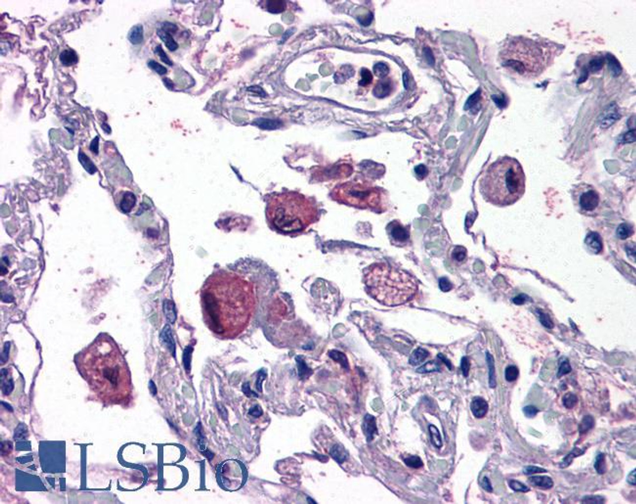 45-242 (3.75ug/ml) staining of paraffin embedded Human Spleen. Steamed antigen retrieval with citrate buffer pH 6, AP-staining.