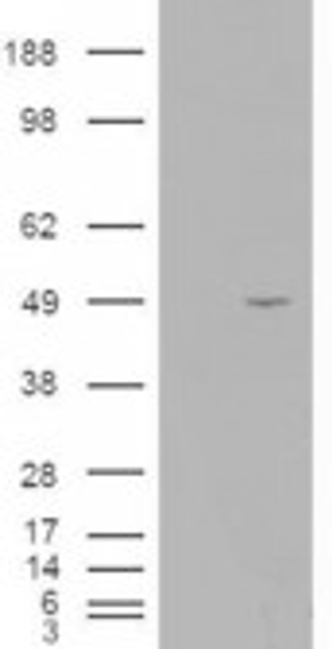 HEK293 overexpressing ILPIP and probed with 45-246 (mock transfection in first lane) .