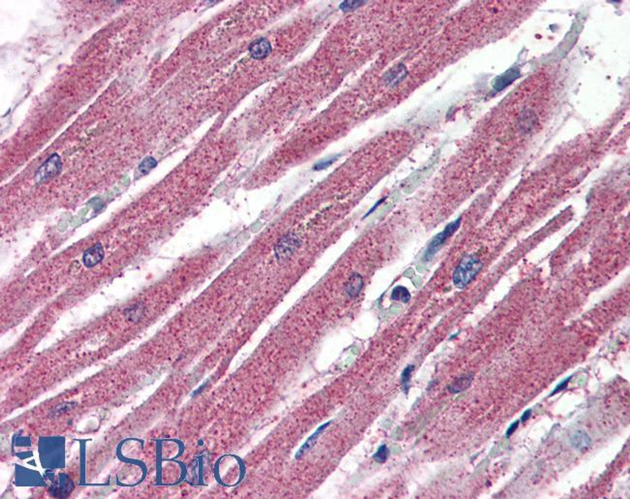 45-248 (4ug/ml) staining of paraffin embedded Human Skeletal Muscle. Steamed antigen retrieval with citrate buffer pH 6, AP-staining.