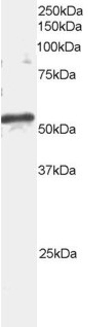 45-278 staining (2ug/ml) of mouse brain extracts (RIPA buffer, 35ug total protein per lane) . Primary incubated for 1 hour. Detected by western blot using chemiluminescence.