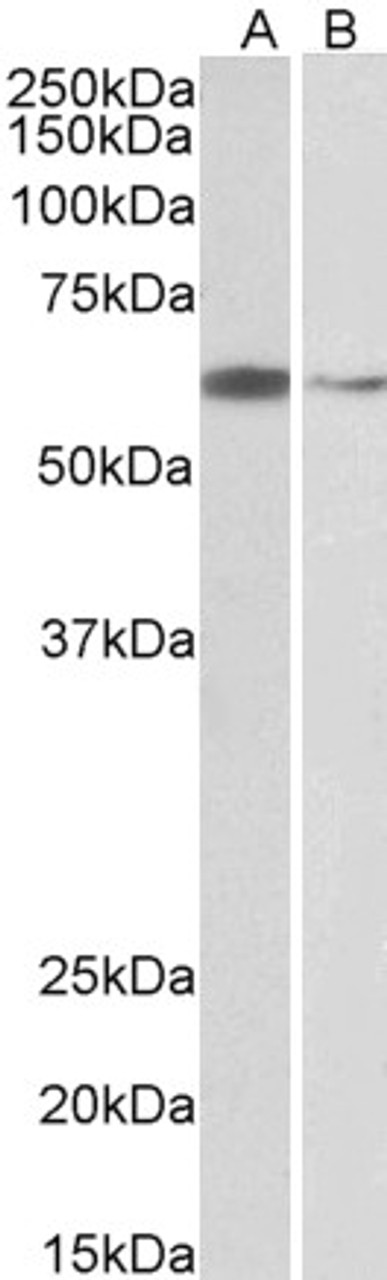 45-283 (2ug/ml) staining of Hela (A) and K562 (B) nuclear lysates (35ug protein in RIPA buffer) . Detected by chemiluminescence.