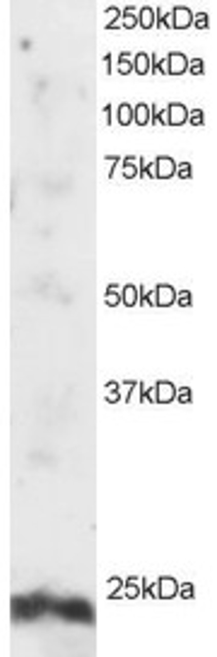 45-286 staining (2ug/ml) of Human Testis lysate (RIPA buffer, 30ug total protein per lane) . Primary incubated for 1 hour. Detected by western blot using chemiluminescence.