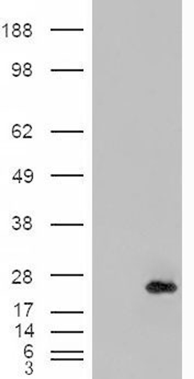 45-288 (0.5ug/ml) staining of Human Brain (Cerebellum) lysate (35ug protein in RIPA buffer) . Primary incubation was 1 hour. Detected by chemiluminescence.