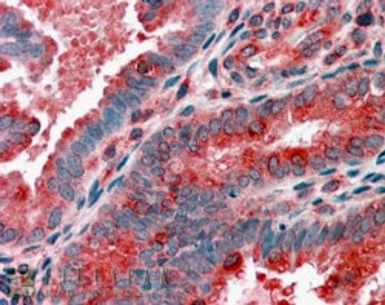 45-291 (3.8ug/ml) staining of paraffin embedded Human Uterus. Steamed antigen retrieval with citrate buffer pH 6, AP-staining.