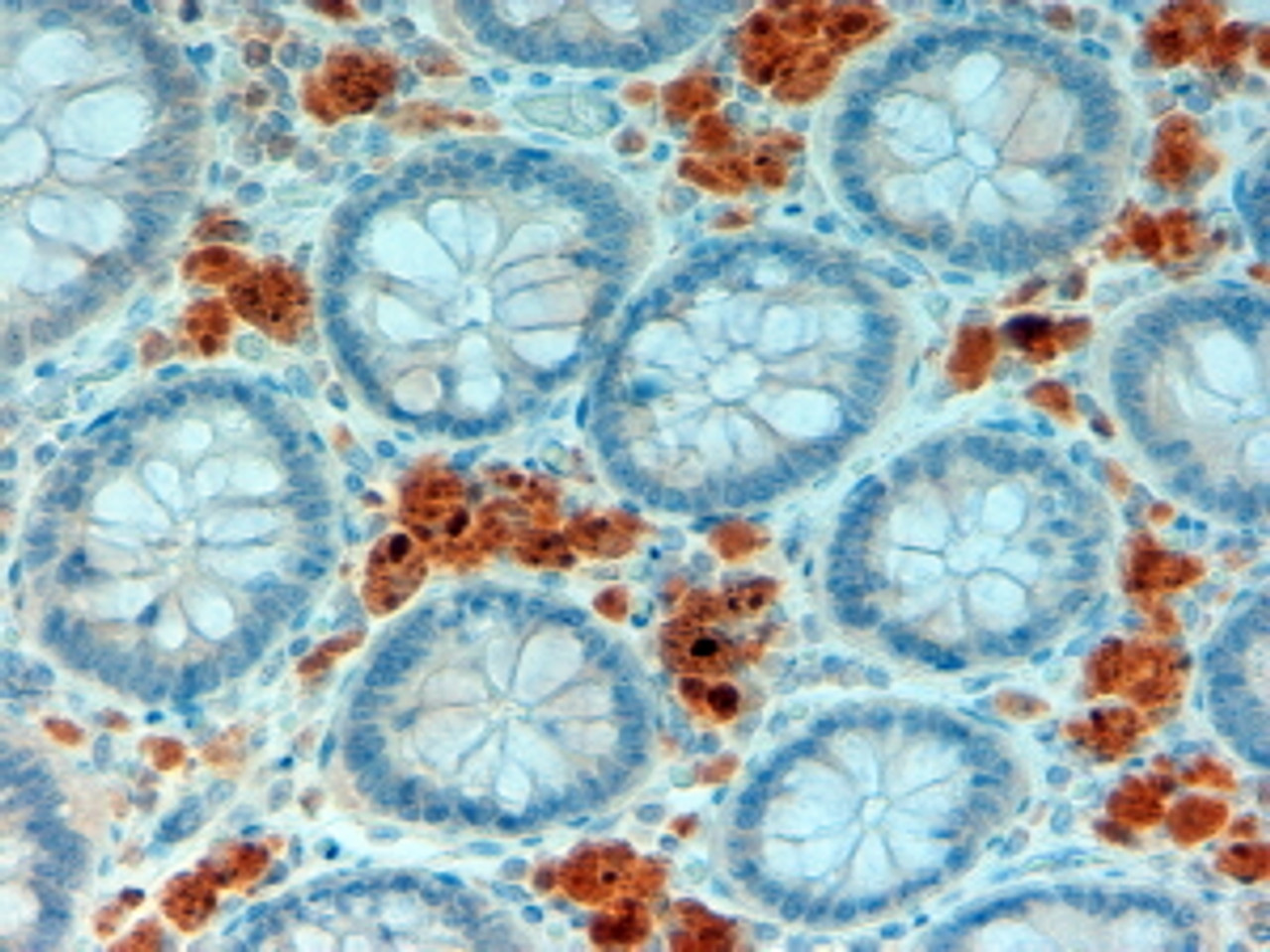 45-298 (3.8ug/ml) staining of paraffin embedded Human Skeletal Muscle. Steamed antigen retrieval with citrate buffer pH 6, AP-staining.