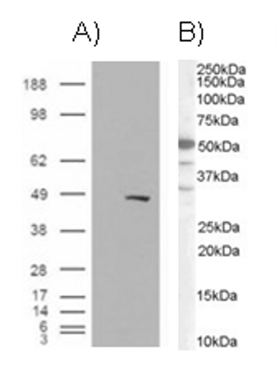 A) HEK293 overexpressing BAF57 (RC209444) and probed with 45-315 (mock transfection in first lane) , tested by Origene. B) see Western Blot.
