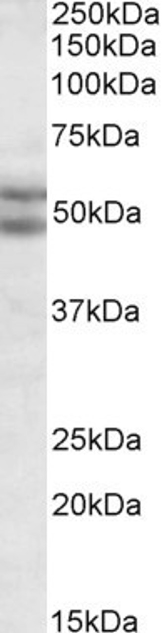 45-318 (2ug/ml) staining of nuclear HeLa lysate (35ug protein in RIPA buffer) . Primary incubation was 1 hour. Detected by chemiluminescence.