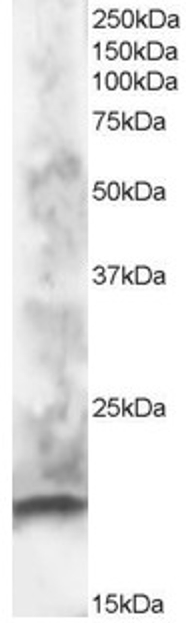 45-349 staining (1ug/ml) of human brain lysate (RIPA buffer, 30ug total protein per lane) . Primary incubated for 1 hour. Detected by western blot using chemiluminescence.