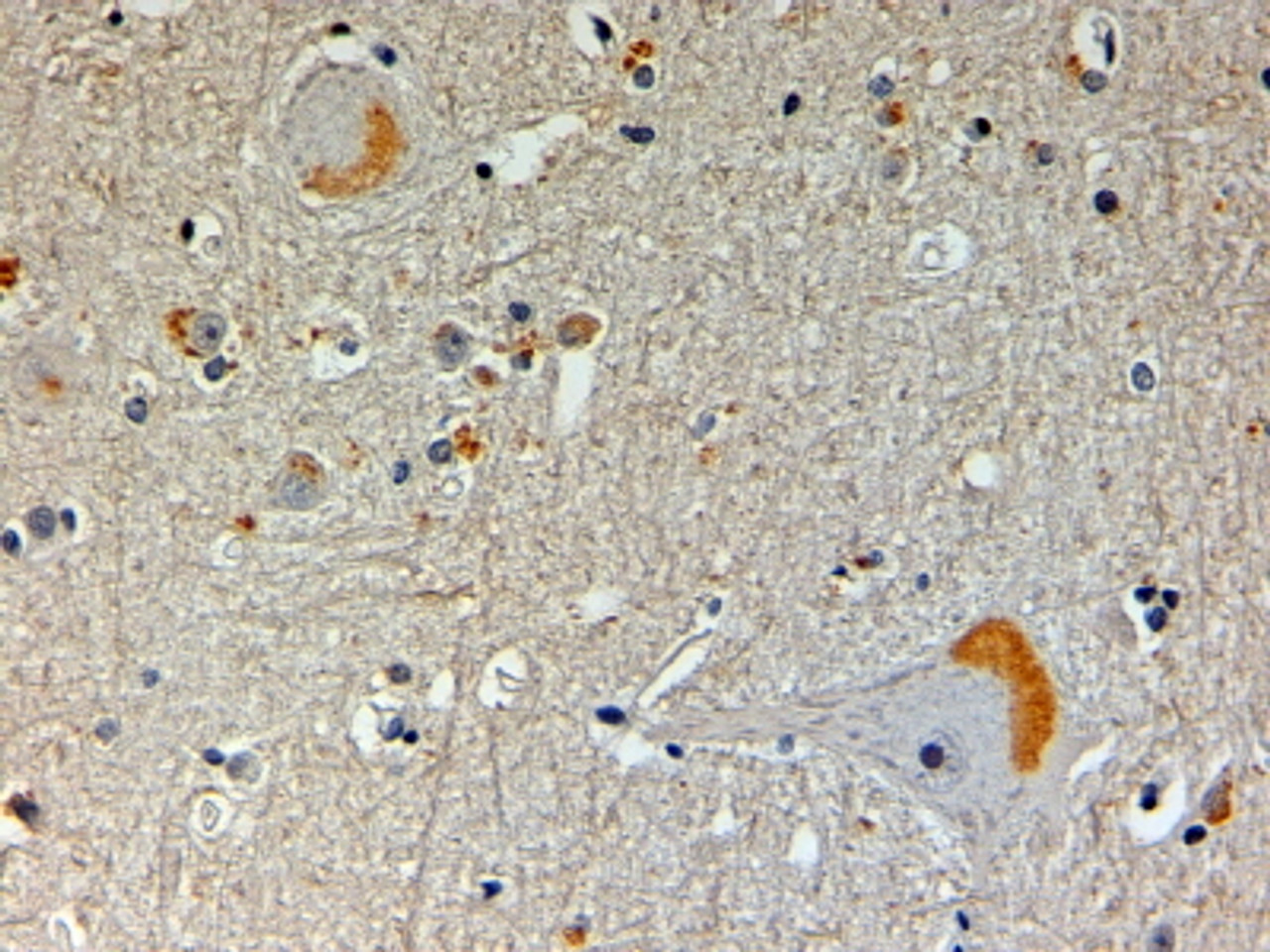 45-357 (4ug/ml) staining of paraffin embedded Human Brain. Steamed antigen retrieval with Tris/EDTA buffer pH 9.5, HRP-staining.