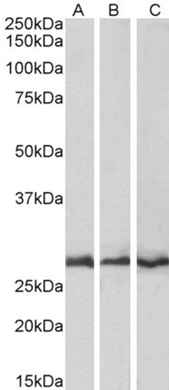 45-359 (0.1ug/ml) staining of Mouse (A) , Rat (B) and Pig (C) Heart lysates (35ug protein in RIPA buffer) . Detected by chemiluminescence.