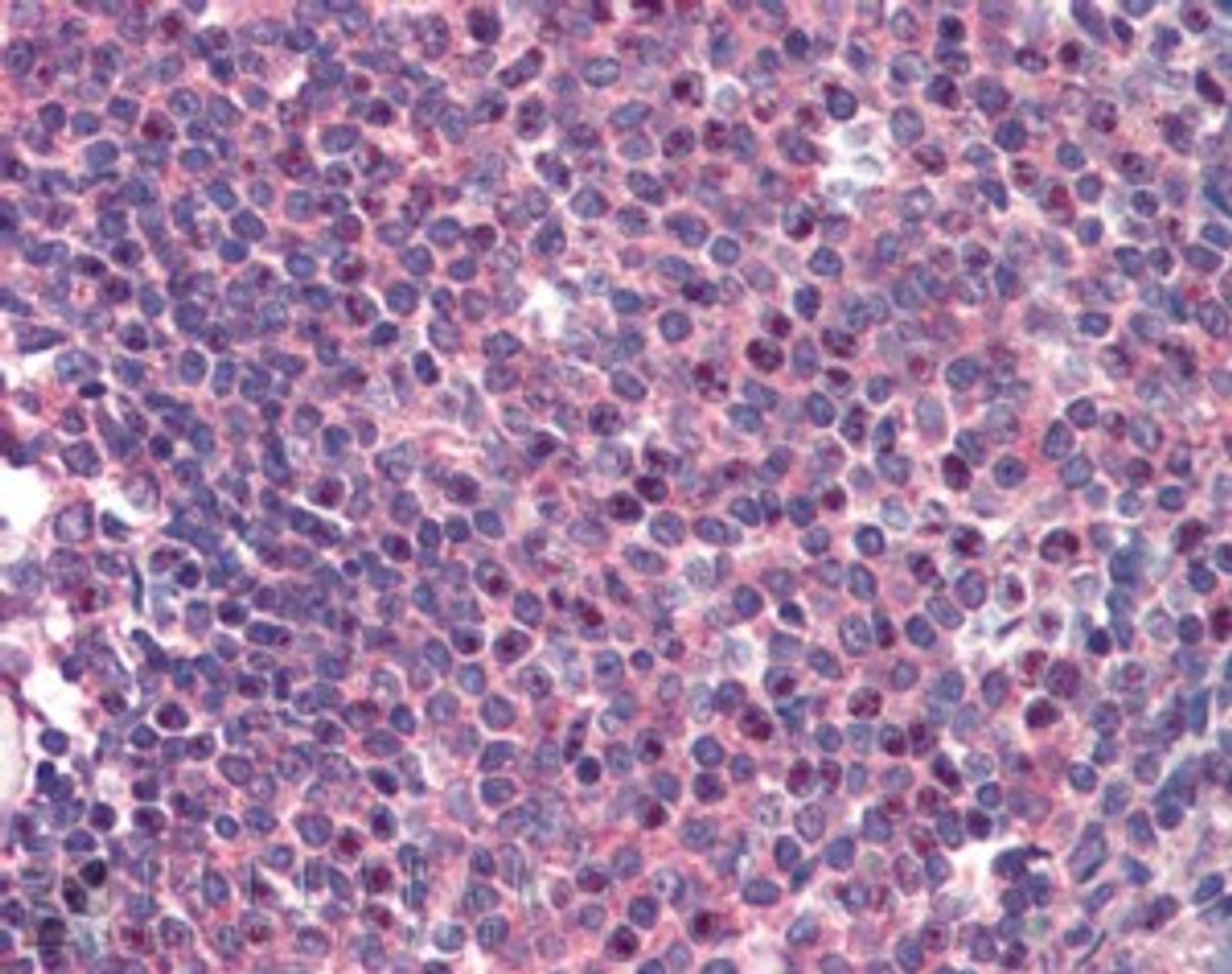 45-360 (2ug/ml) staining of paraffin embedded Human Spleen. Steamed antigen retrieval with citrate buffer pH 6, AP-staining.