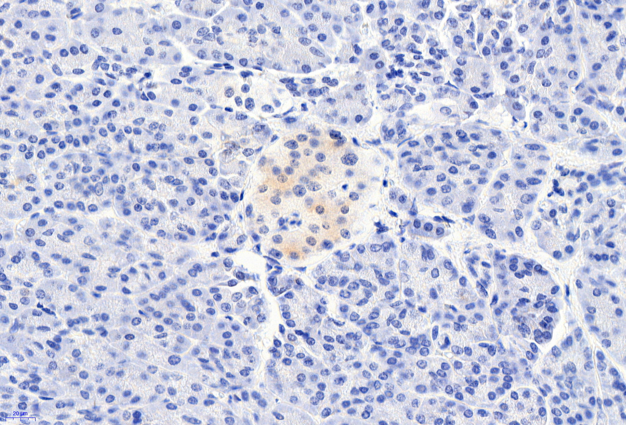 45-378 (5ug/ml) staining of paraffin embedded Human Uterus. Steamed antigen retrieval with citrate buffer pH 6, AP-staining.