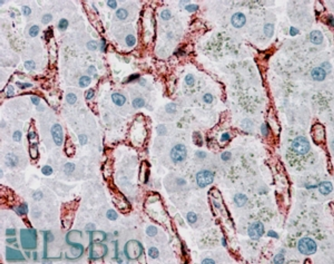 45-383 (1ug/ml) staining of Daudi cell lysate (RIPA buffer, (35ug protein in RIPA buffer) . Detected by chemiluminescence.