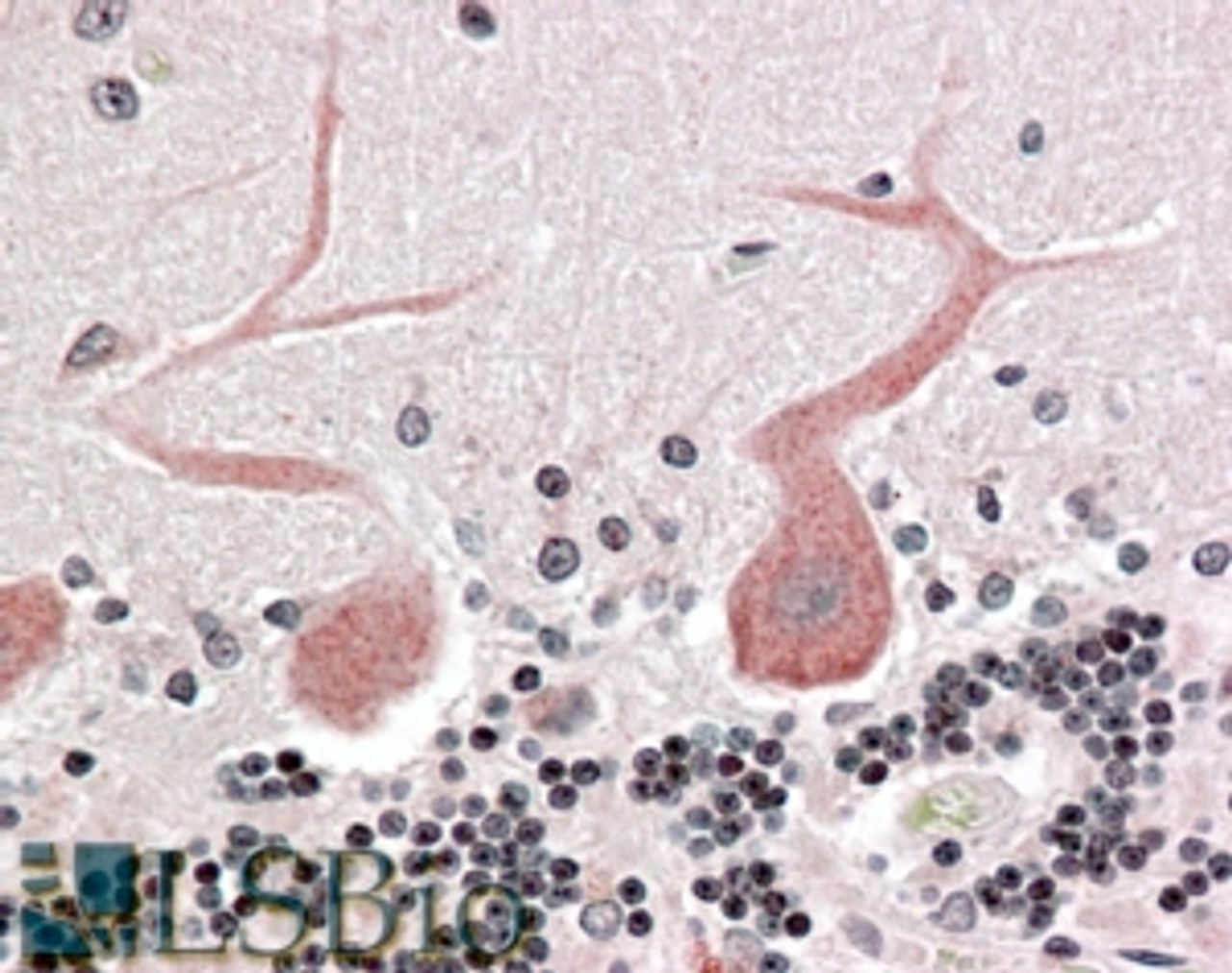 45-384 (3.8ug/ml) staining of paraffin embedded Human Cerebellum Steamed antigen retrieval with citrate buffer pH 6, AP-staining.