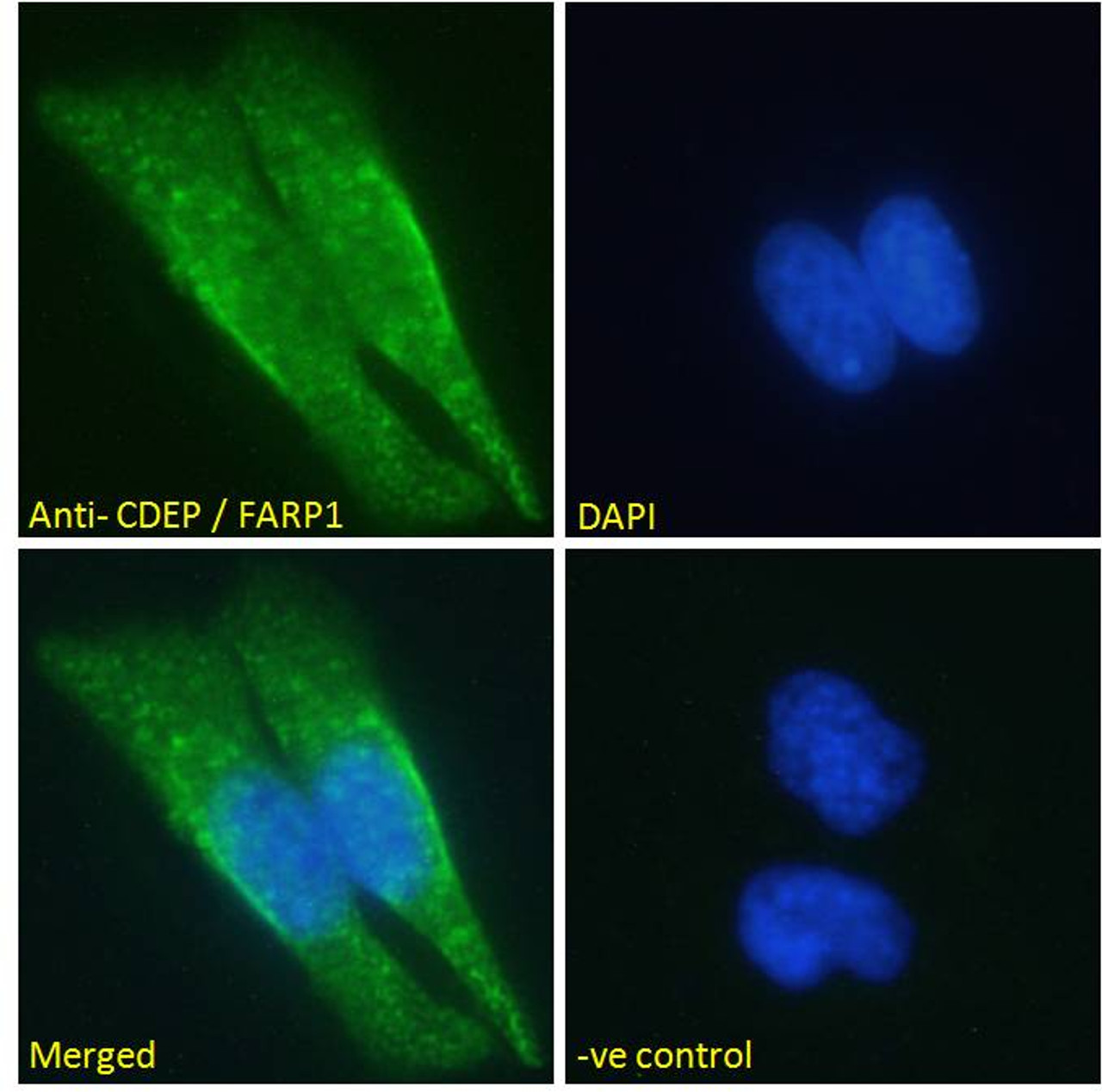 45-385 Immunofluorescence analysis of paraformaldehyde fixed HeLa cells, permeabilized with 0.15% Triton. Primary incubation 1hr (10ug/ml) followed by Alexa Fluor 488 secondary antibody (2ug/ml) , showing cytoplasmic staining. The nuclear stain is DAPI (b