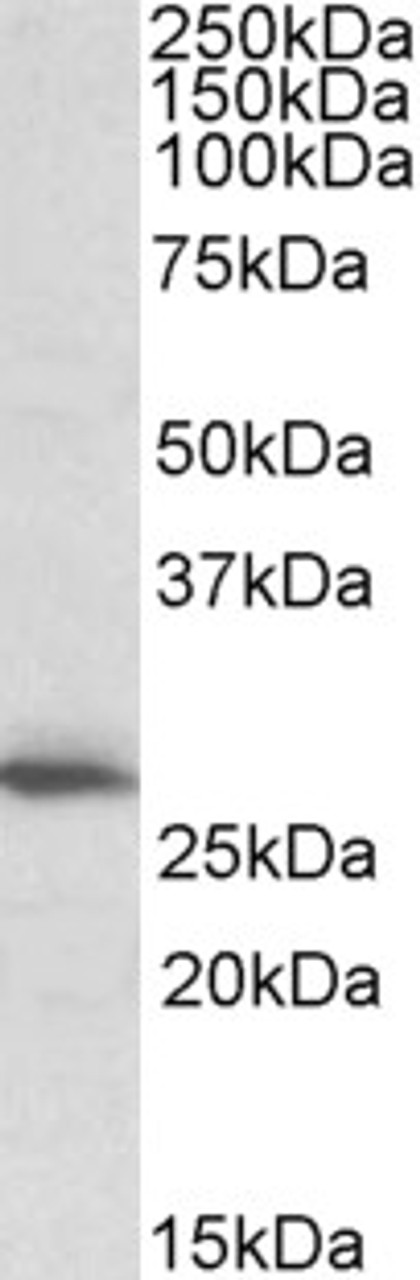 45-406 (1ug/ml) staining of Human Heart lysate (35ug protein in RIPA buffer) . Primary incubation was 1 hour. Detected by chemiluminescence.