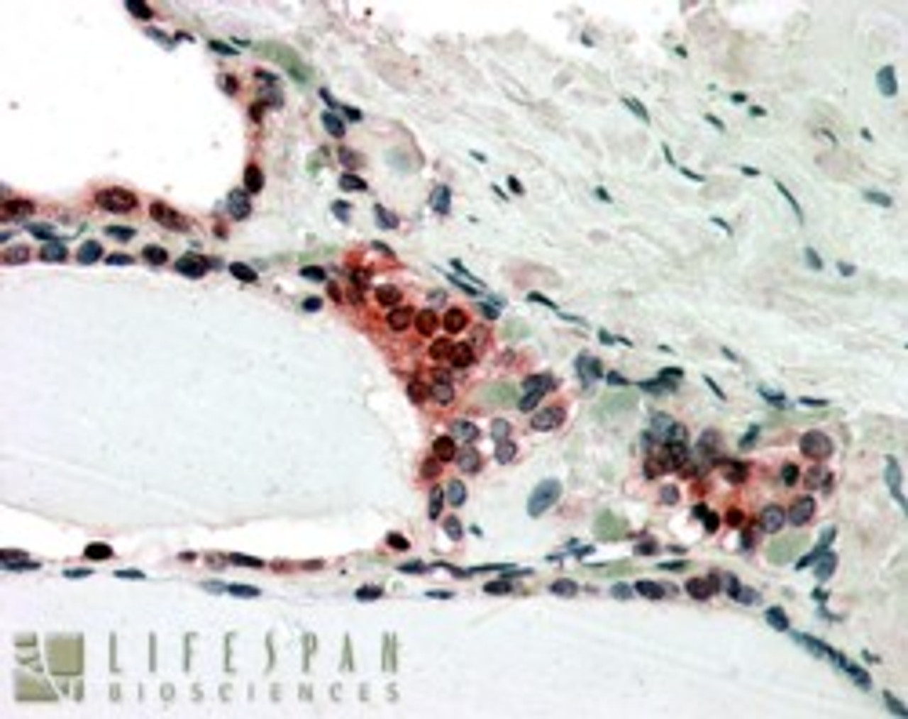 In paraffin embedded Human Thyroid Gland shows nclear and cytoplasm staining in activated epithelial cells Recommended concentration, 3-5ug/ml.
