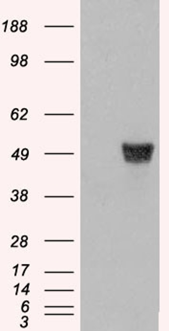 HEK293 overexpressing CORO1A and probed with 45-421 (mock transfection in first lane) .