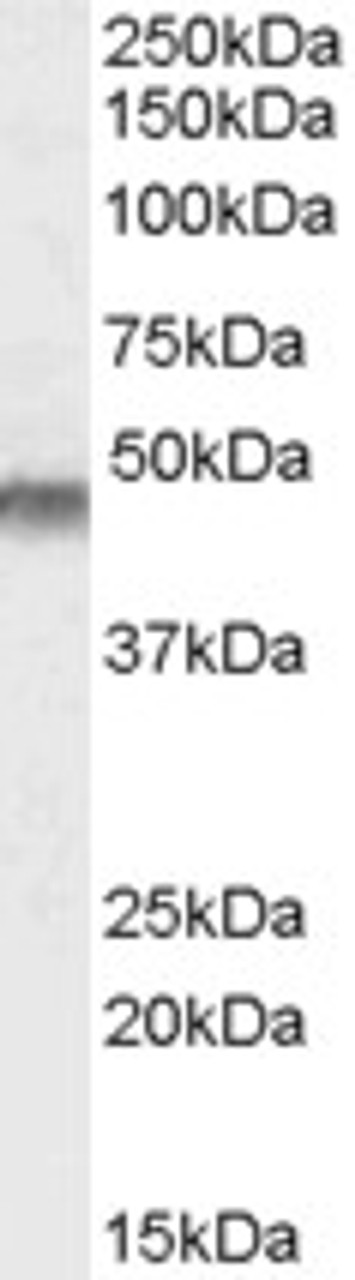 HEK293 overexpressing CRP2 and probed with 45-433 (mock transfection in first lane) .