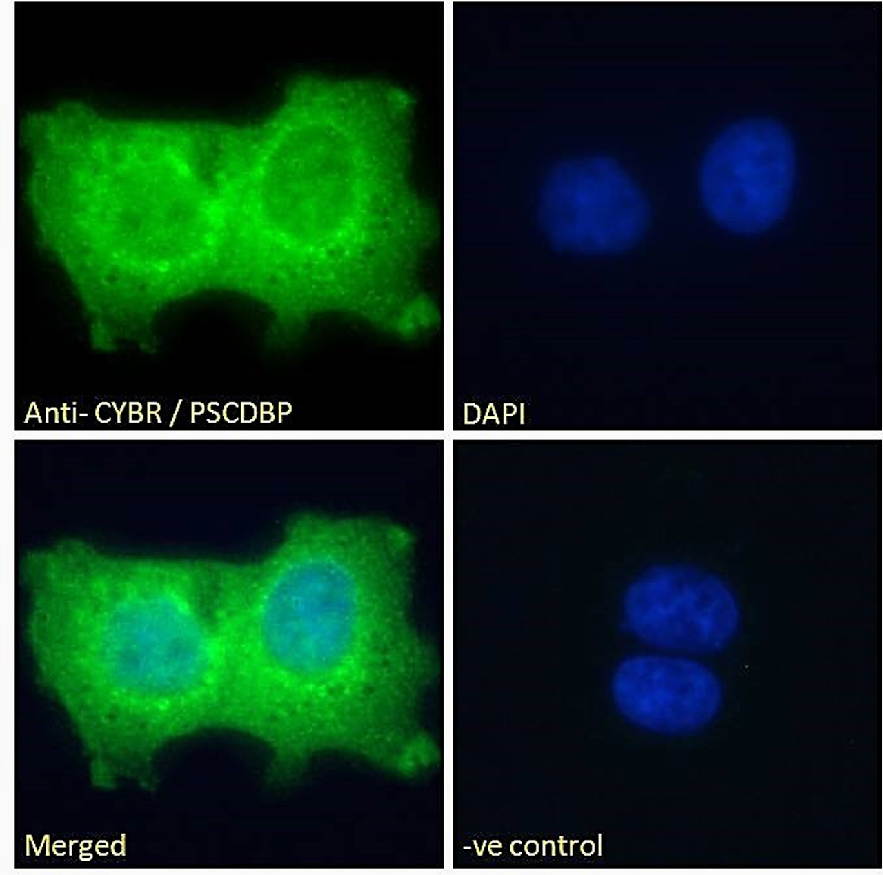 45-441 Immunofluorescence analysis of paraformaldehyde fixed A431 cells, permeabilized with 0.15% Triton. Primary incubation 1hr (10ug/ml) followed by Alexa Fluor 488 secondary antibody (2ug/ml) , showing cytoplasmic and nuclear staining. The nuclear stai