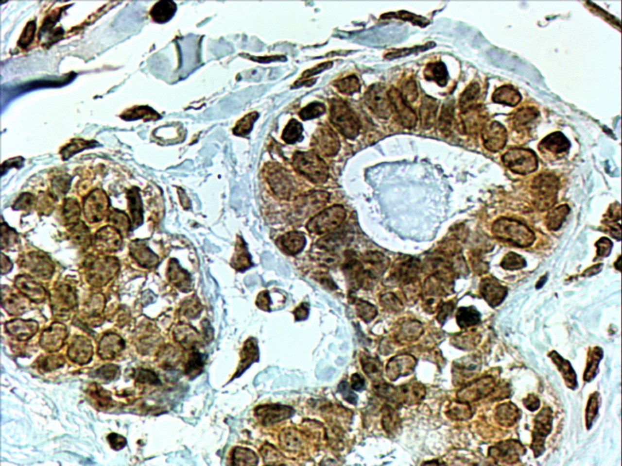45-449 (4ug/ml) staining of paraffin embedded Human Breast. Steamed antigen retrieval with citrate buffer pH 6, HRP-staining.