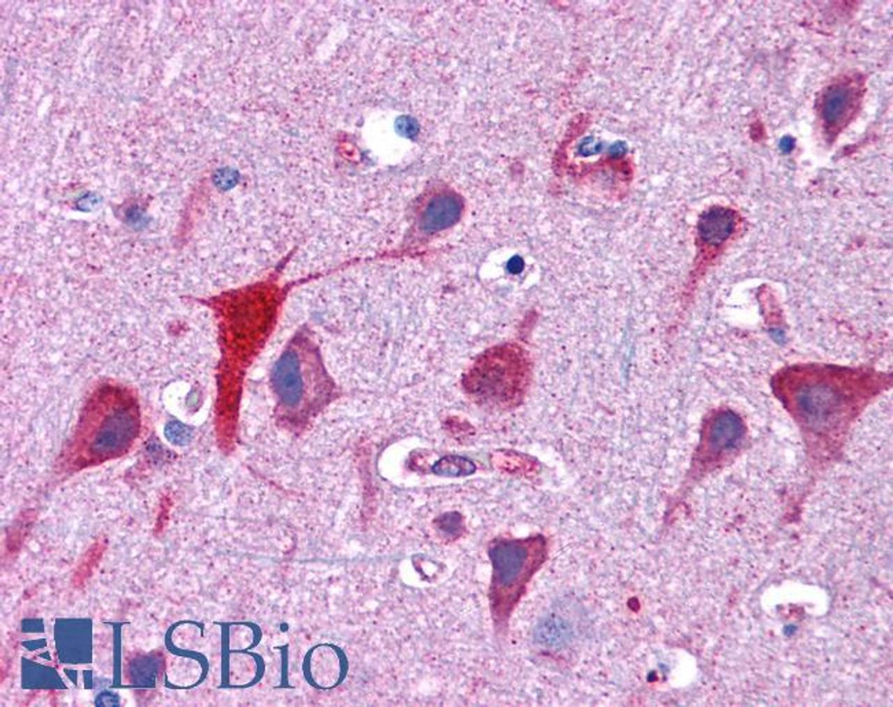 45-455 (3.75ug/ml) staining of paraffin embedded Human Spleen. Steamed antigen retrieval with citrate buffer pH 6, AP-staining.