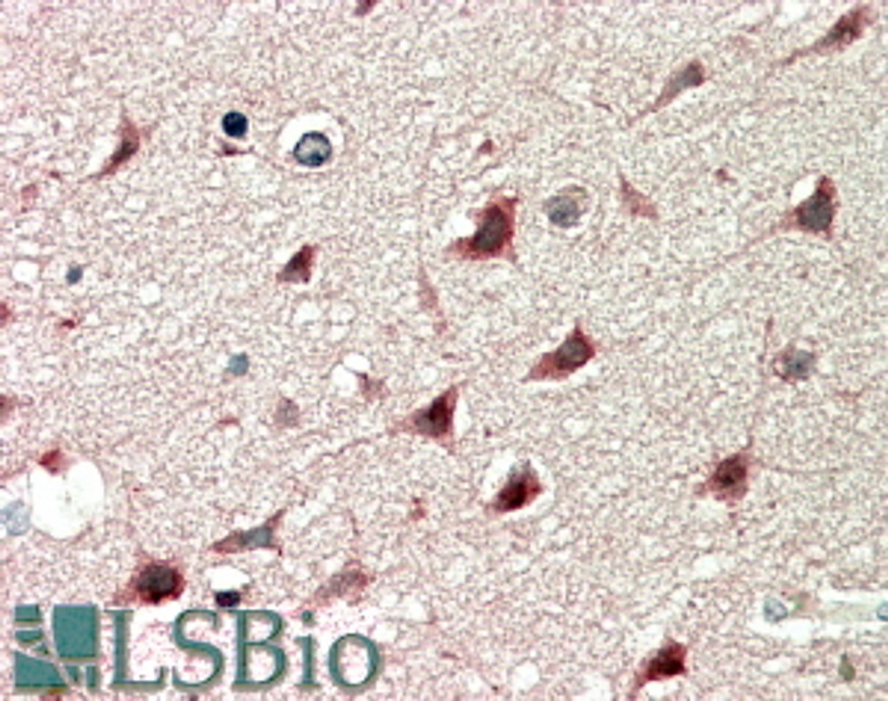 45-464 (0.2ug/ml) staining of COS7 cell lysate transfected with full length recombinant human DCDC2 (A) and untransfected control COS7 cells (B) . Primary incubation was 1 hour. Detected by chemiluminescence.