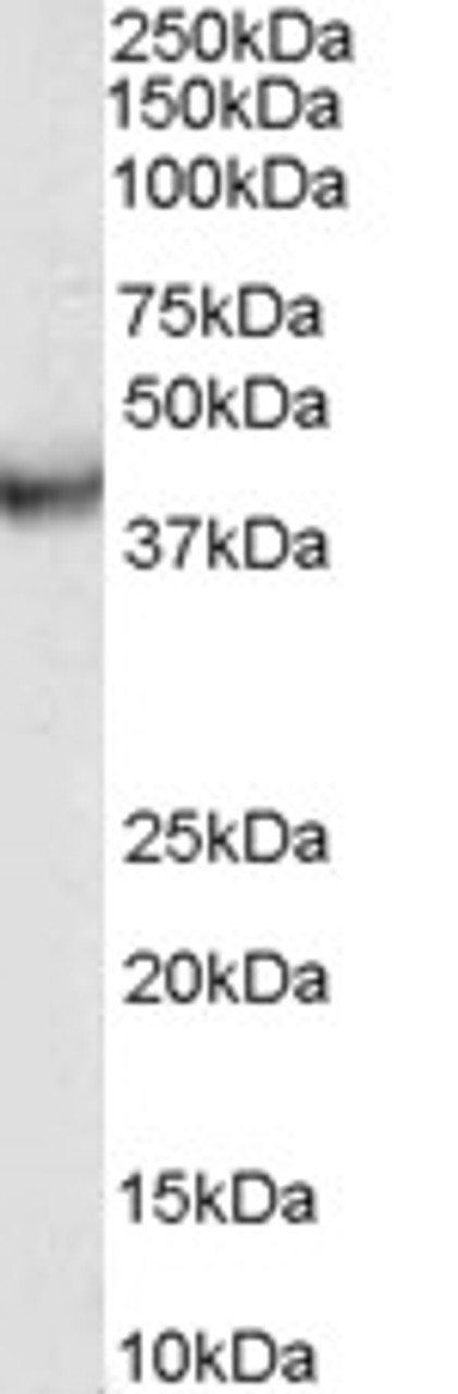 45-466 (5ug/ml) staining of paraffin embedded Human Skeletal Muscle. Steamed antigen retrieval with citrate buffer pH 6, AP-staining.