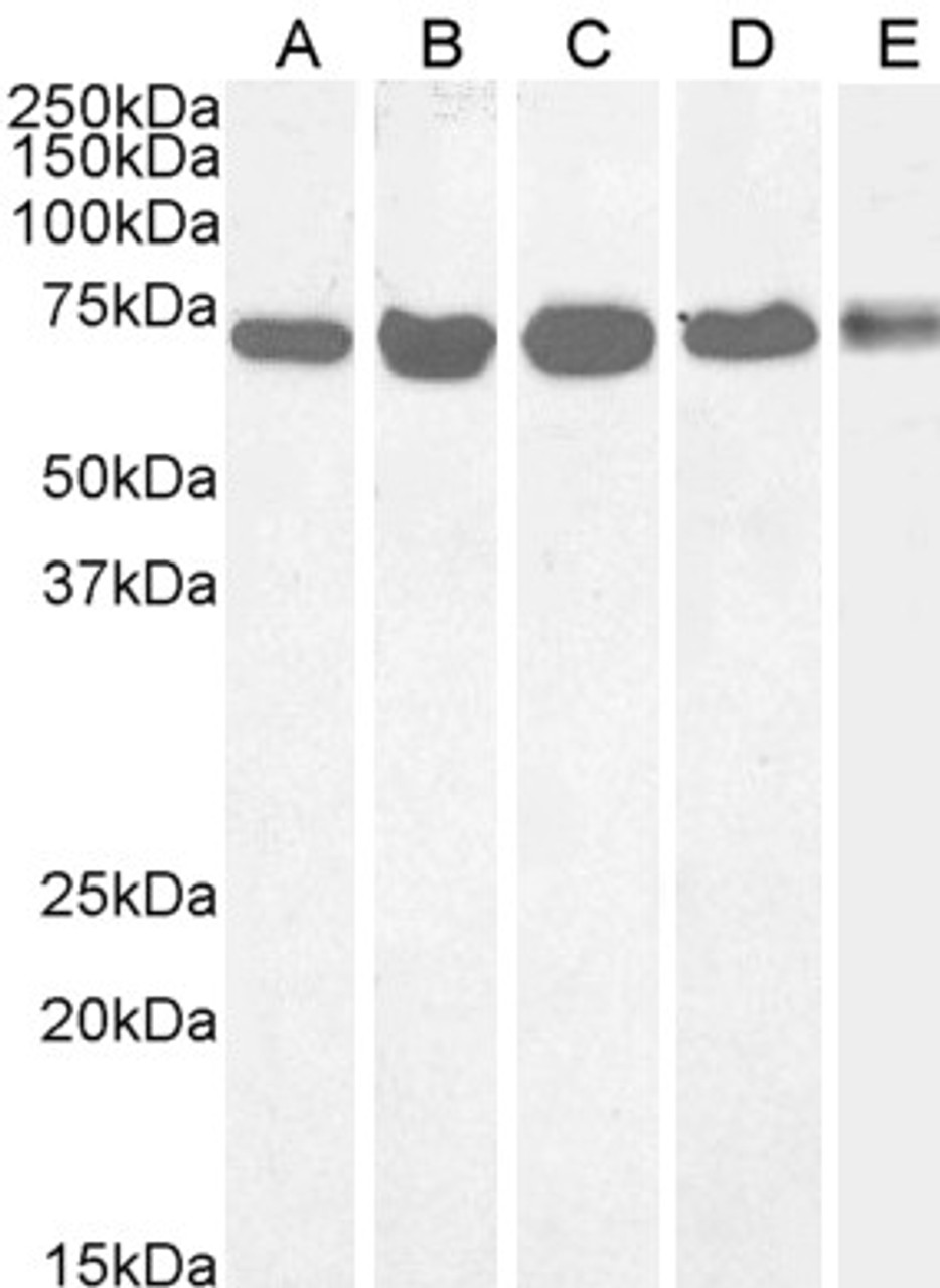 45-470 (0.5ug/ml) staining of cell lines A431 (A) , HeLa (B) , HepG2 (C) , Jurkat (D) and NIH3T3 (E) lysate (35ug protein in RIPA buffer) . Primary incubation was 1 hour. Detected by chemiluminescence.