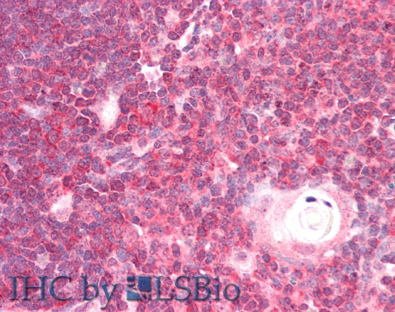 45-471 (5ug/ml) staining of paraffin embedded Human Cortex. Steamed antigen retrieval with citrate buffer pH 6, AP-staining.