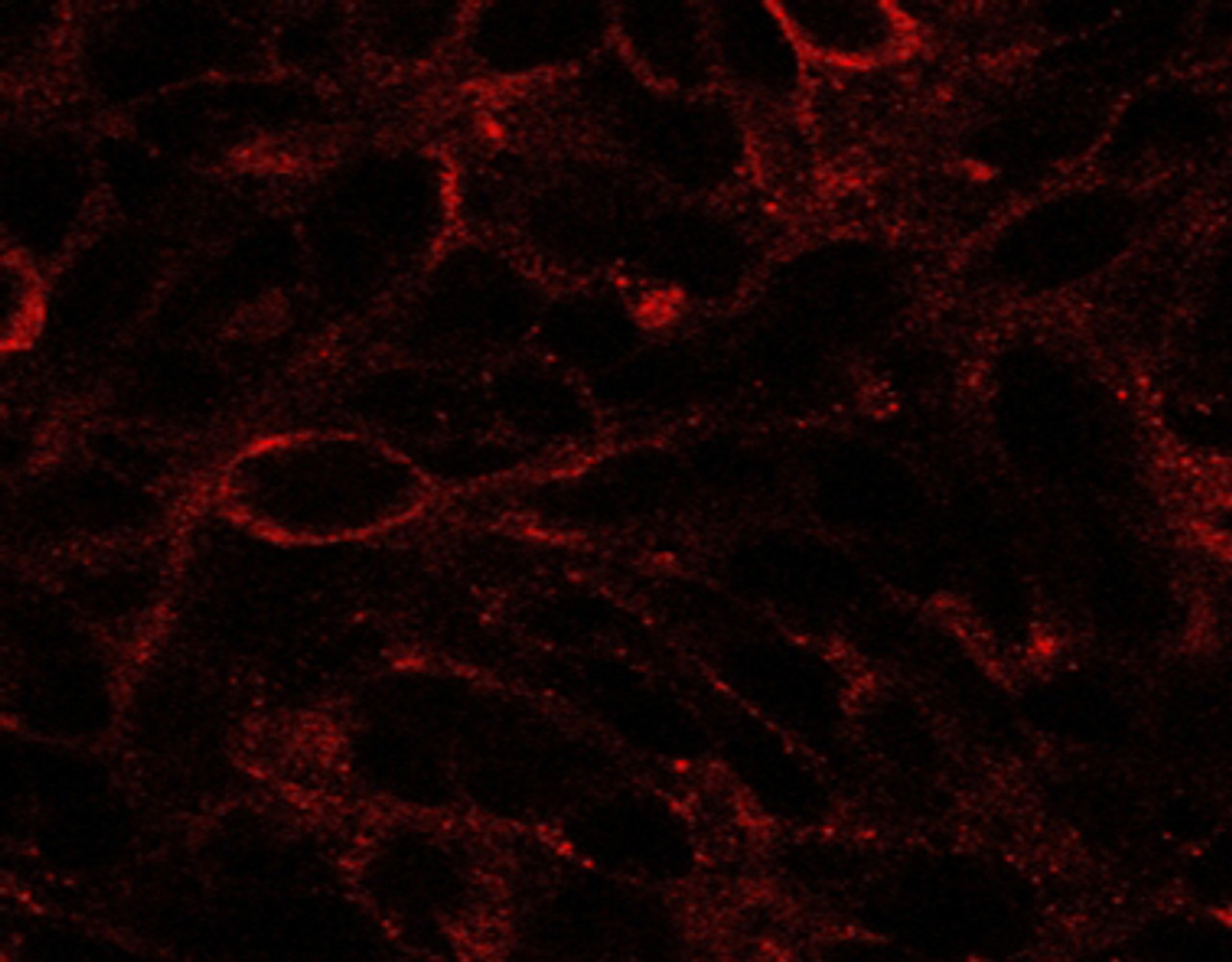 45-482 (2.5ug/ml) staining of U87. Detected by immunofluorescence. Data provided by Dr. Aashir Awan, University of Madrid, Spain.