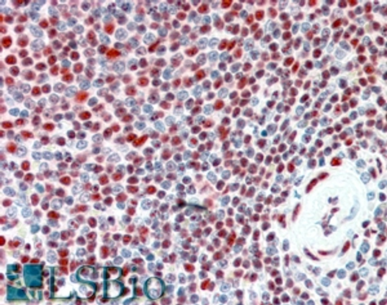 45-483 (5ug/ml) staining of paraffin embedded Human Spleen. Steamed antigen retrieval with citrate buffer pH 6, AP-staining.