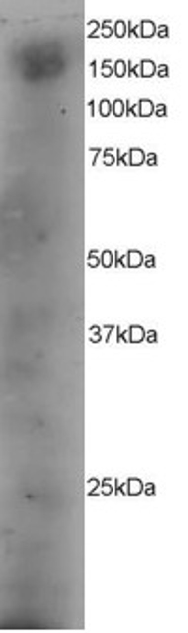 45-489 staining (4ug/ml) of A431 lysate (RIPA buffer, 35ug total protein per lane) . Primary incubated for 12 hour. Detected by western blot using chemiluminescence.