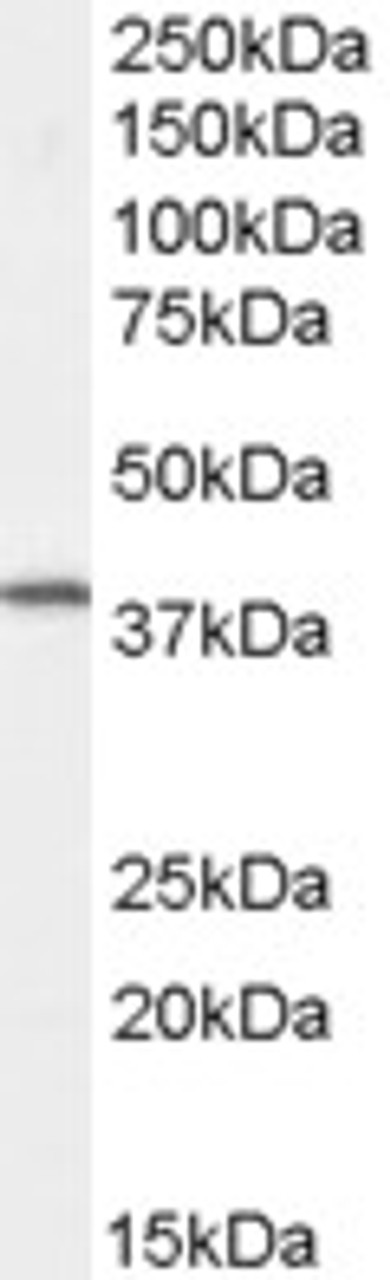 45-510 staining (0.5ug/ml) of Human Spleen lysate (RIPA buffer, 30ug total protein per lane) . Primary incubated for 1 hour. Detected by chemiluminescence.