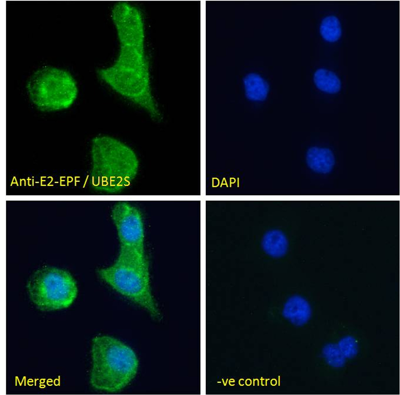 45-513 Immunofluorescence analysis of paraformaldehyde fixed A431 cells, permeabilized with 0.15% Triton. Primary incubation 1hr (10ug/ml) followed by Alexa Fluor 488 secondary antibody (2ug/ml) , showing cytoplasmic and nuclear staining. The nuclear stai