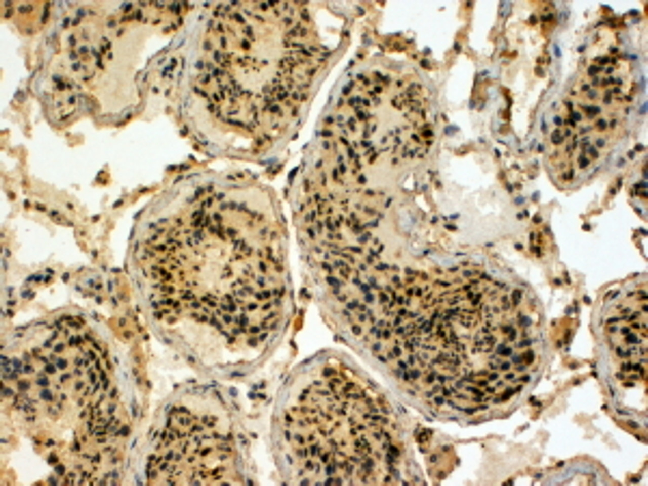 45-518 (4ug/ml) staining of paraffin embedded Human Testis. Steamed antigen retrieval with Tris/EDTA buffer pH 9, HRP-staining. These results could not be obtained after antigen retrieval at pH6.
