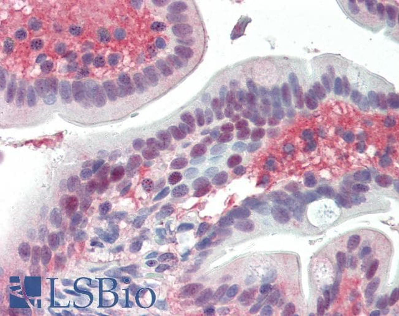 45-521 (2ug/ml) staining of lysates of cell line HepG2 (35ug protein in RIPA buffer) . Detected by chemiluminescence.